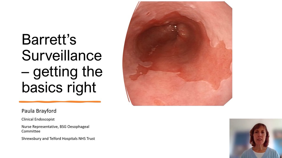 Our latest Web Education content addition is a video presentation by Paula Brayford 💻 aiming to improve the confidence &amp; practice of non-expert endoscopists undertaking Barrett's surveillance to help increase detection of Barrett's dysplasia 👇 bsg.org.uk/web-education/…