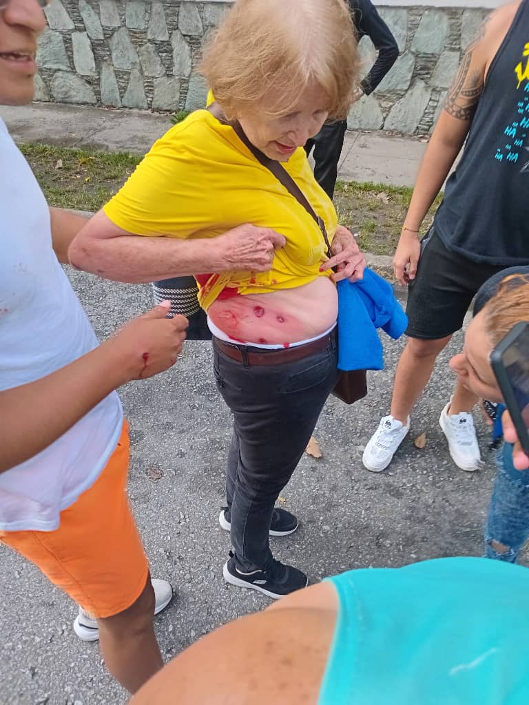 ReporteYa's tweet photo. #29Jul #Caracas #Protestas
@JeanCGR: Señora herida por perdigones en Montalbán https://t.co/s0kPzWbPtv