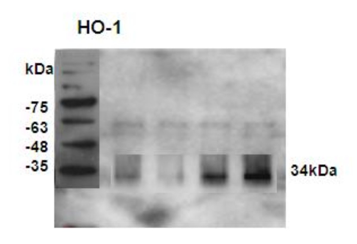 Elisabeth Bik (@microbiomdigest) on Twitter photo How on earth did <a href="/SciReports/">Scientific Reports</a> approve this figure as an "uncropped" blot?
#imageForensics How on earth did <a href="/SciReports/">Scientific Reports</a> approve this figure as an "uncropped" blot?
#imageForensics