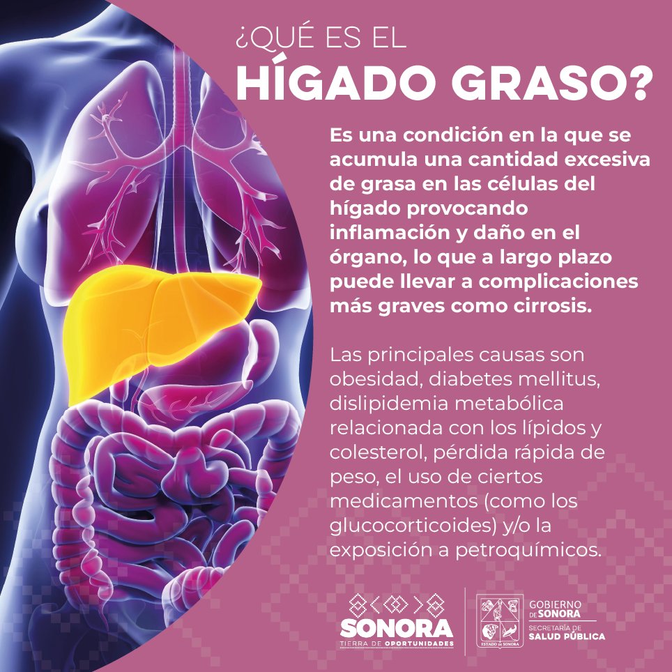 La obesidad, la diabetes y otros factores de riesgo pueden causar hígado  graso! Esta enfermedad inflama tu hígado y puede llevar a la cirrosis.  ¡Conoce los síntomas y prevén complicaciones! ⤵️ #SaludSonora, image size:964x964