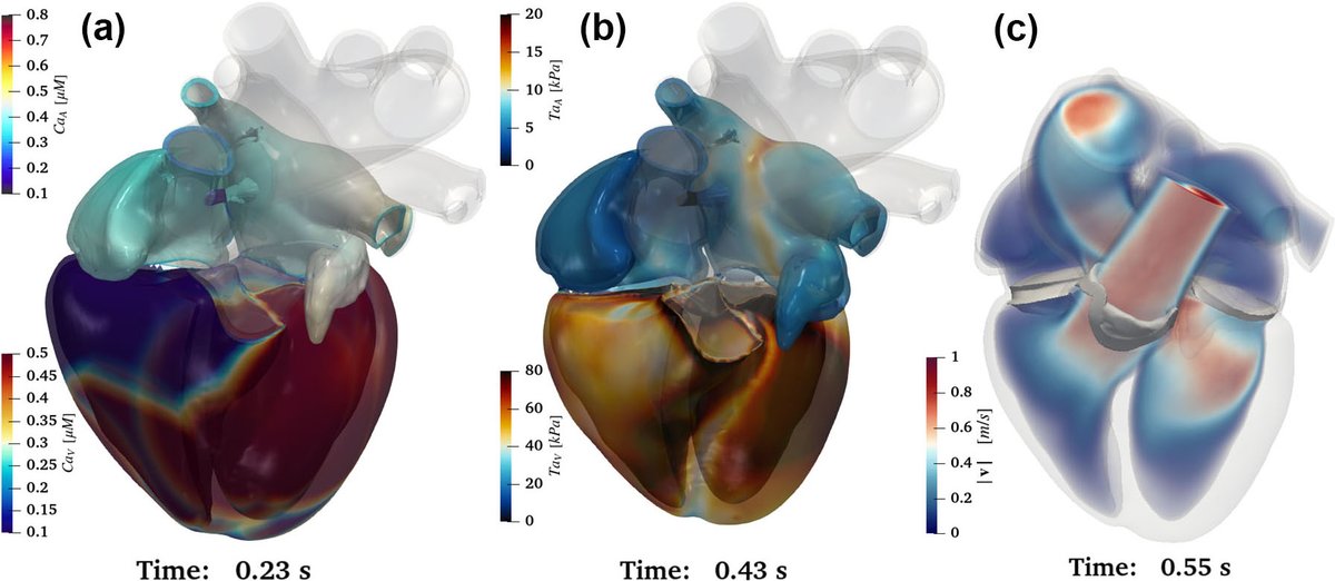 SIAM (@thesiamnews) on Twitter photo On the SIAM News blog, <a href="/AlfioQuarteroni/">Alfio Quarteroni</a> discusses the iHEART simulator: a comprehensive #computational model that employs innovative #mathematical techniques to advance understanding of #cardiac function and aid #clinical decision-making. Take a look! siam.org/publications/s… On the SIAM News blog, <a href="/AlfioQuarteroni/">Alfio Quarteroni</a> discusses the iHEART simulator: a comprehensive #computational model that employs innovative #mathematical techniques to advance understanding of #cardiac function and aid #clinical decision-making. Take a look! siam.org/publications/s…