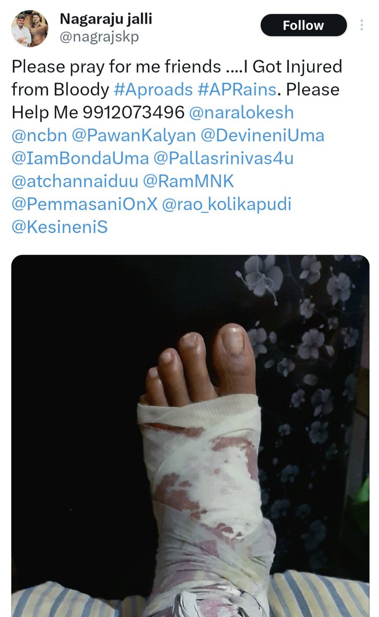 andhraa360's tweet image. ఏపీ రోడ్లు - ఒక జనసైనికుడీ దీన వేడుకోలు 

కూటమి పాలనలో అతివృష్టి వల్ల, రోడ్లు ఇంకా దారుణంగా తయారయ్యాయి.

తన కాలు విరిగిన, మిగతావారికి ఇలా జరుగకూడదు అనే సదుద్దేశంతో డిప్యూటి సిఎం, సిఎం, తదితరులకు విజ్ఞప్తి చేసిన ఏపీ యువ ప్రజానీకం.

#APRoads #AndhraPradesh #DeputyCM