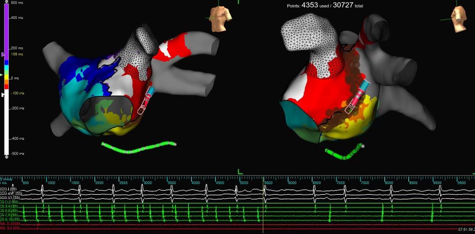 Jun Beltran tweet media