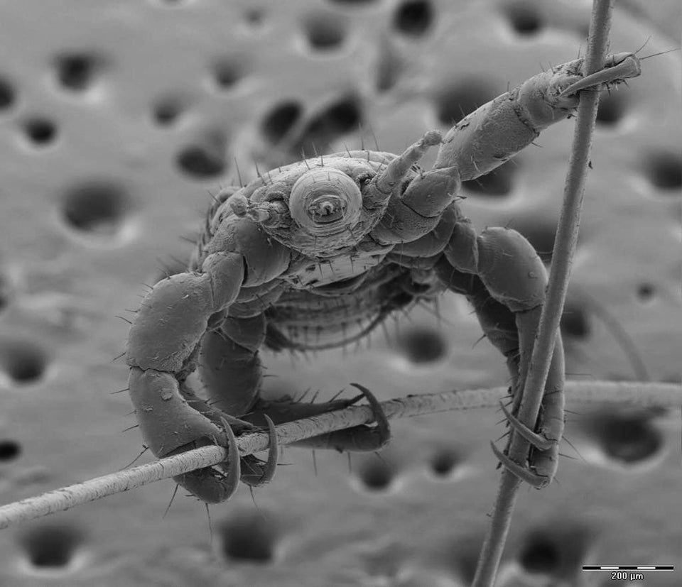 EnsedeCiencia's tweet photo. Así es como se ve un piojo sujetándose del cabello de una persona, visto a través de un microscopio electrónico de barrido (SEM). 😲🔬   

Crédito de imagen: A quien corresponda. https://t.co/nExBLIw4RB