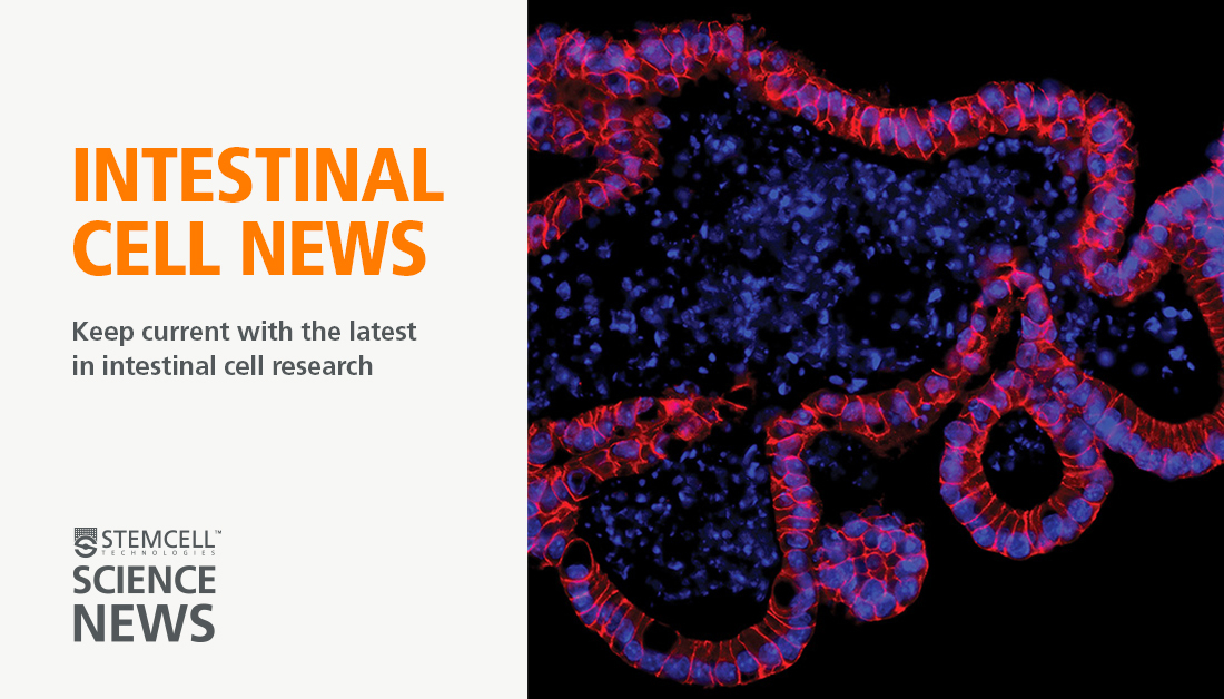 Intestinal_Cell's tweet photo. Looking to stay up to date on the latest intestinal research? ๐
Subscribe to #IntestinalCell News for free bi-weekly newsletters.
https://t.co/QhmRruwEyE https://t.co/5FIM4JldSk