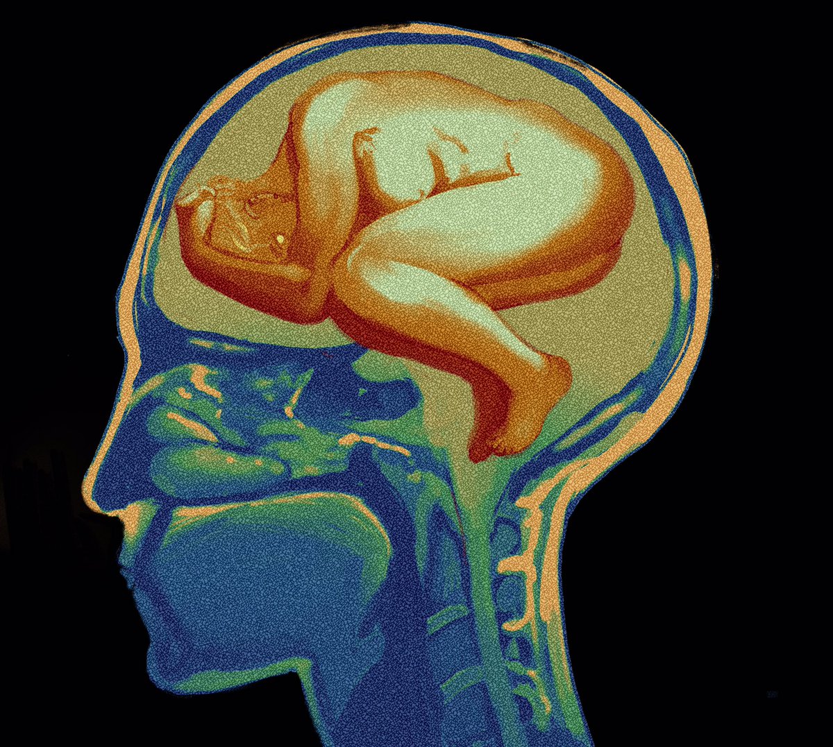 matimattiii's tweet photo. Pre-lobotomy MRI #TheLockedTomb https://t.co/W6bytfrOKl