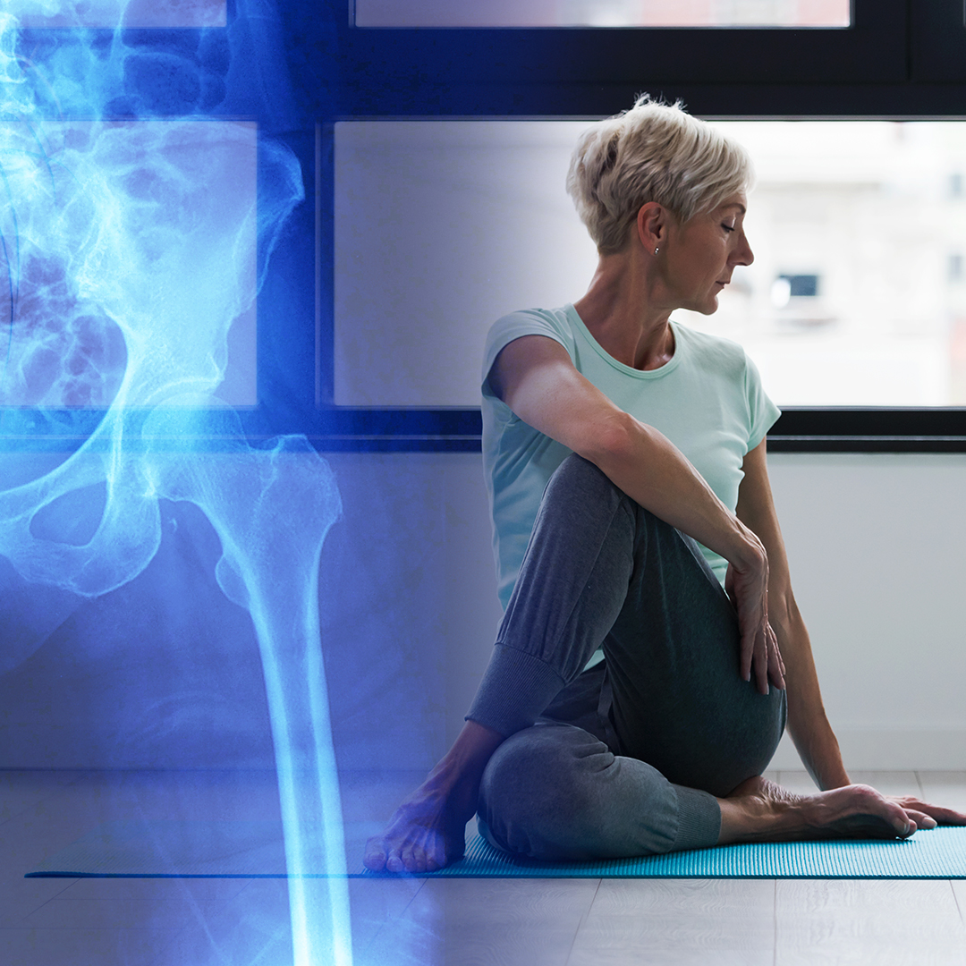 BodycompImaging's tweet photo. Did you know? Women over 30 should start regular #BoneDensity checks to prevent osteoporosis. 🌟

#Osteoporosis affects 200M+ people worldwide, often leading to fractures. 🦴

Pre-#menopause diagnosis is key! Get your bone density #DEXA scan at https://t.co/y8OZwJdJQ8 today! 🏃‍♀️ https://t.co/HDanXj2jQf