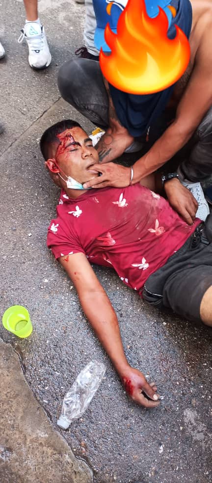 Vuela alto "pimpina", ofrendaste tu vida por la libertad de nuestra Venezuela. Ya no volveremos a comer sopa juntos pero Dios iluminará el camino hacia una Venezuela libre!

No eras político, no tenías  adversarios, tu único propósito un país mejor!
Esto fue en Carapita Antimano