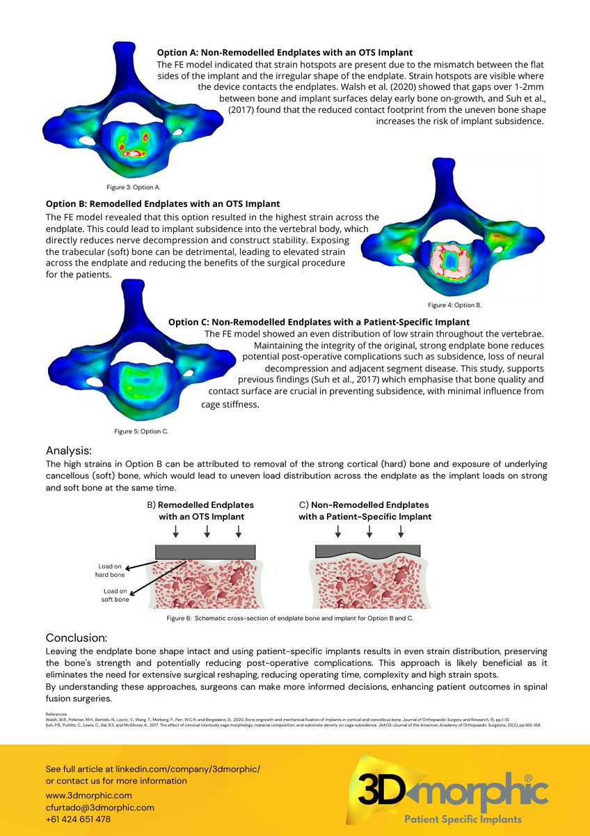 3DMorphic's tweet photo. What impact does endplate remodelling have on successful spinal fusion? ​

#SpinalFusion #HealthRevolution #MedicalBreakthrough https://t.co/cCVbFz52yz