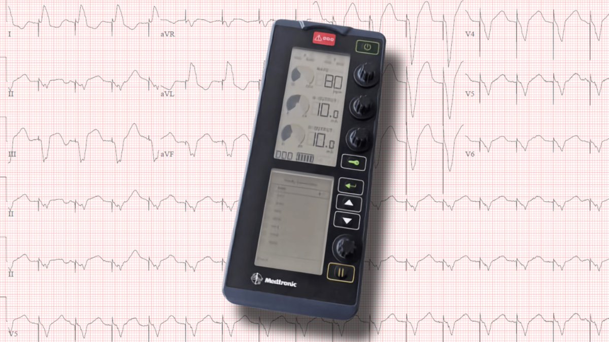 Emergency medicine doctors: Join us at our transvenous pacing skill station on Sept. 13. Learn to place a temporary pacemaker wire for patients with life-threatening bradycardia using our high-fidelity simulator. #EmergencyMedicine #CME emergencymedicine.duke.edu/education/cont…