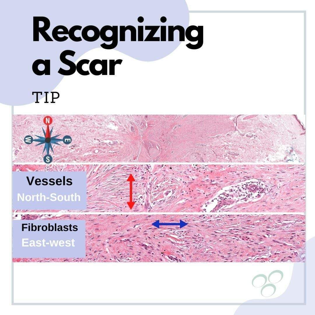GeronimoJrLapac's tweet image. #dermpath #Pathology
