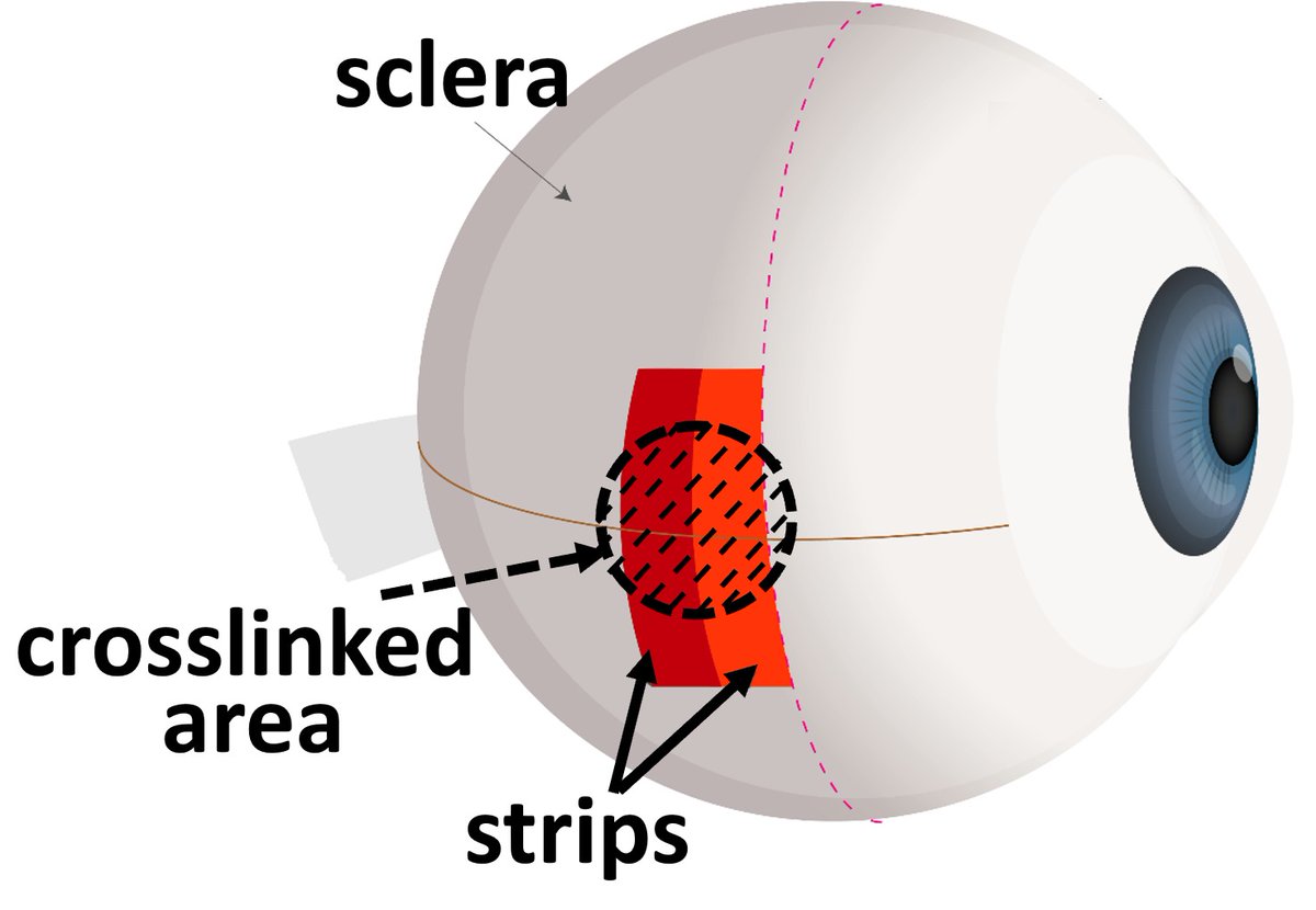 Rose Bengal and green light irradiation for #scleral #crosslinking  and more in our latest paper ⬇️
 iovs.arvojournals.org/article.aspx?a…

#biomechanics #stiffness #hydration #myopia <a href="/VioBioLab/">VioBioLab</a> <a href="/MarcoslabUr/">MarcosLab_UR</a> <a href="/IO_CSIC/">Instituto de Óptica (CSIC)</a> 
Let's highlight the main points 🧵