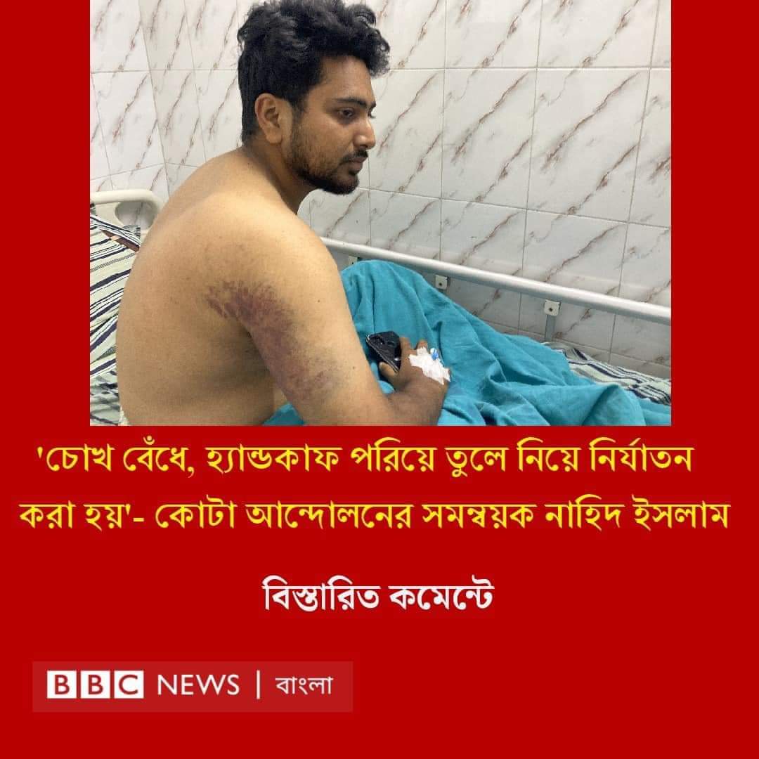 Rakibuzzaman_bd's tweet photo. The world is watching as Bangladeshi students face violence for protesting peacefully. Governments must protect, not persecute, their youth. #SaveBangladeshiStudents #StepDownHasina #ProtectTheProtest @usembassydhaka https://t.co/BHlwaXVGhD