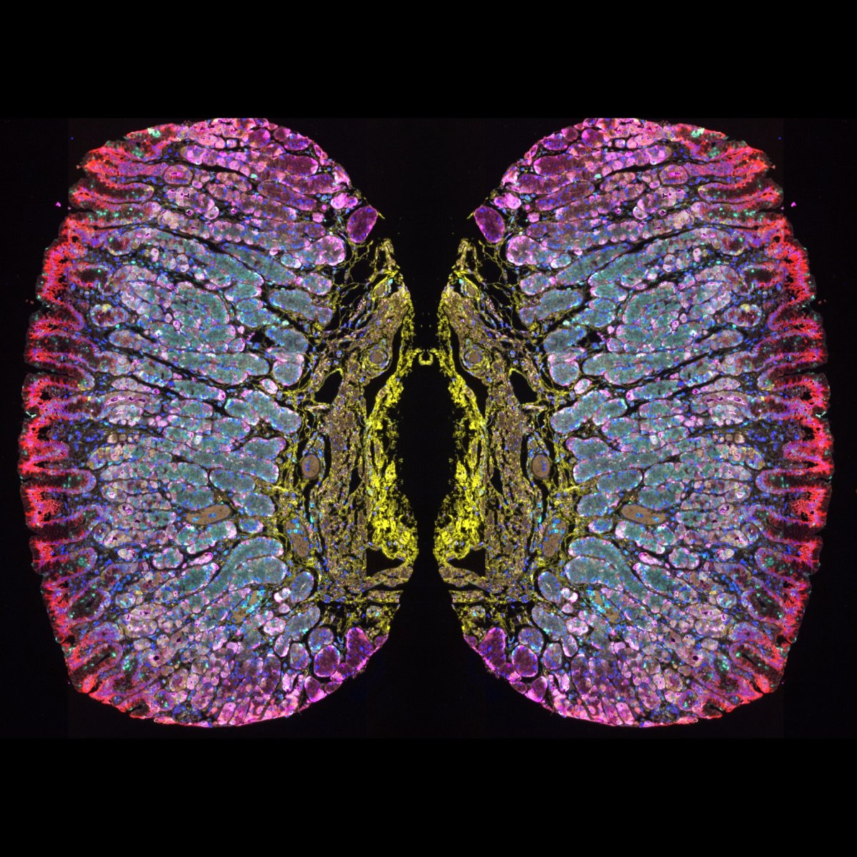 AkoyaBio's tweet image. Discovering beauty in science with this remarkable image 🦋... It's not a butterfly, but two mirror images of a healthy human stomach #tissuemicroarray (TMA) core stained with PanCK, RAMP1, Stathmin1, and ATP4B.
This stunning image, imaged with #PhenoImagerHT, is a testament to…