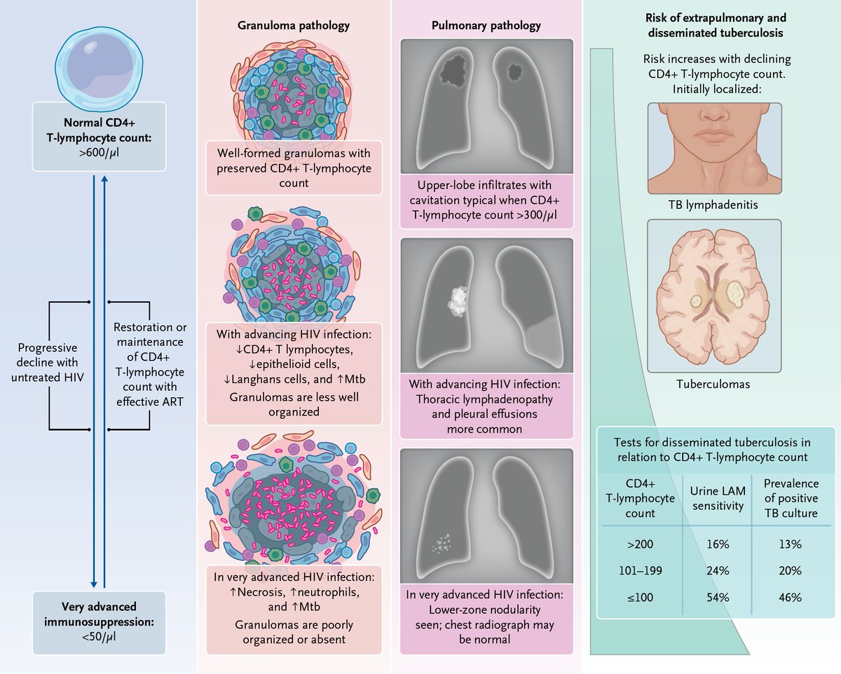 Almost half of inpatients with HIV-associated tuberculosis in countries with a high disease burden of HIV and tuberculosis have mycobacteremia, and features of sepsis are commonly present.  

Read the full review: nej.md/3LCGmHD 1/8 

#IDTwitter