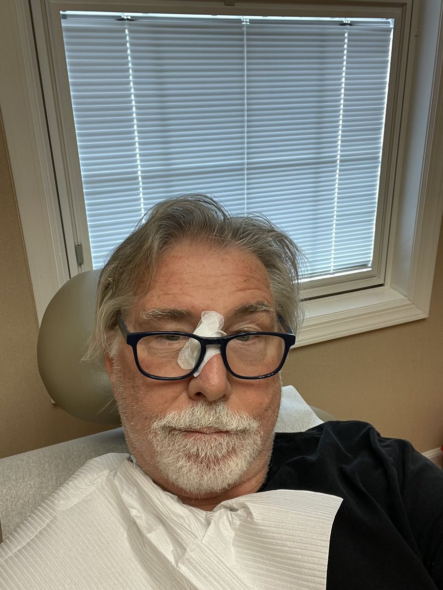 MarkMcKenna419's tweet photo. Lucky me! Another basal cell skin cancer removed.. this one was close to my eye on bridge of nose. I think that makes 12 I've had removed!? #skincancer #basalcell #dermotology https://t.co/gACjERywLi