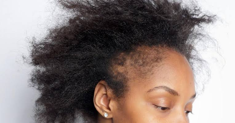 Nig_Farmer's tweet photo. #NaijaFarmerTips

How do I move from frame 1 to frame 2 real quick?

If you are wondering what to do to have a full, soft hair without knots and breakage, then this tip is for you.

 - Soak rice in water for 2-3 days 

-  Wash your hair with the rice water 

- Use continuously for 3-4 weeks

Switch up your hair game today! 

You can explore more tips in the Basic Home Remedies eBook for just #5000. Ready to buy? Visit this link https://t.co/tFdfWs8sMi