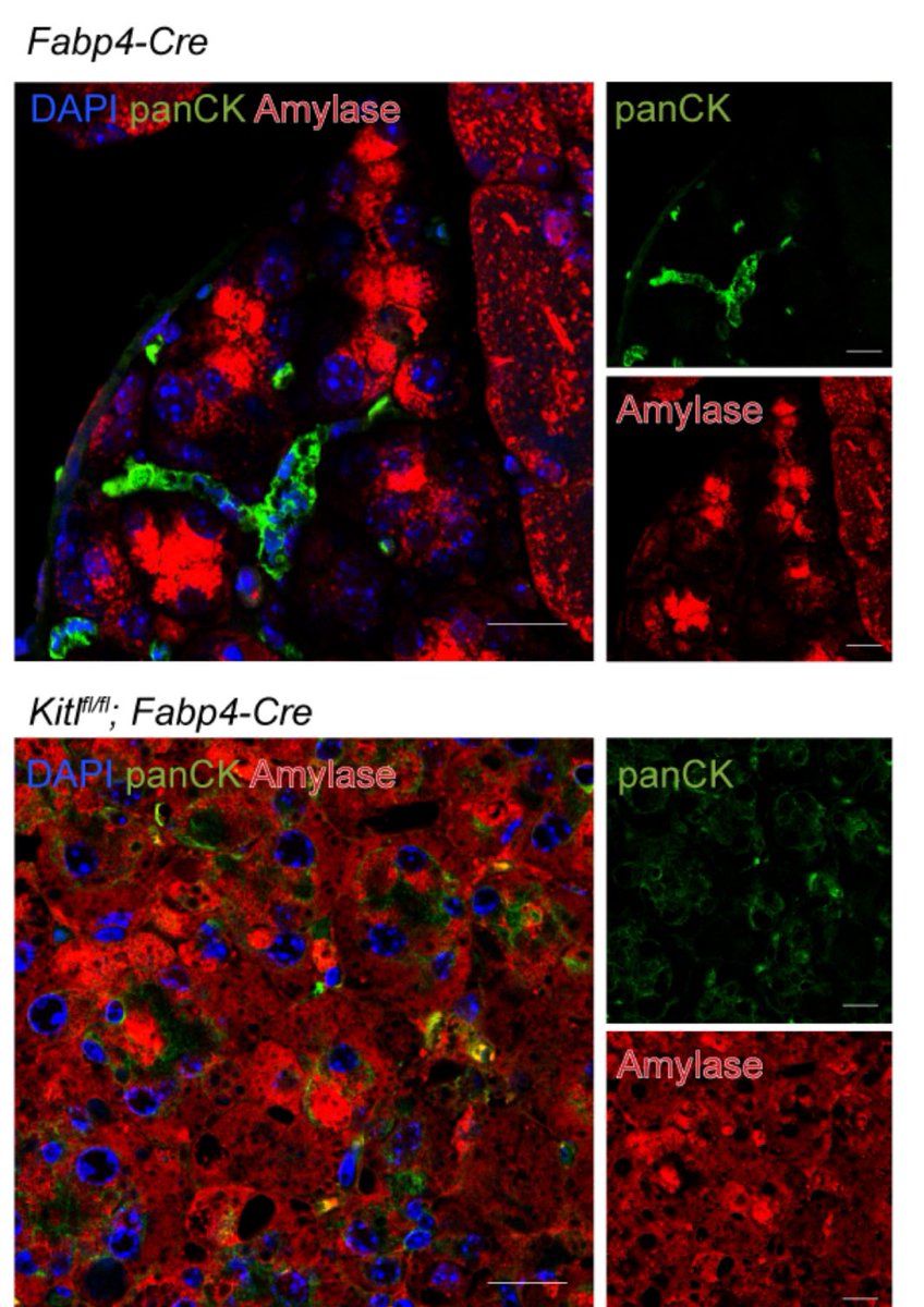 Anirban Maitra (@aiims1742) on Twitter photo New preprint from <a href="/MaraShermanLab/">Mara Sherman Lab</a> <a href="/MSKCancerCenter/">Memorial Sloan Kettering Cancer Center</a>
Stromal KITL/SCF promotes pancreas tissue homeostasis and restrains tumor progression
biorxiv.org/content/10.110…
This study examines what factor(s) in the normal pancreatic mesenchyme might be lost in the process of multistep New preprint from <a href="/MaraShermanLab/">Mara Sherman Lab</a> <a href="/MSKCancerCenter/">Memorial Sloan Kettering Cancer Center</a>
Stromal KITL/SCF promotes pancreas tissue homeostasis and restrains tumor progression
biorxiv.org/content/10.110…
This study examines what factor(s) in the normal pancreatic mesenchyme might be lost in the process of multistep