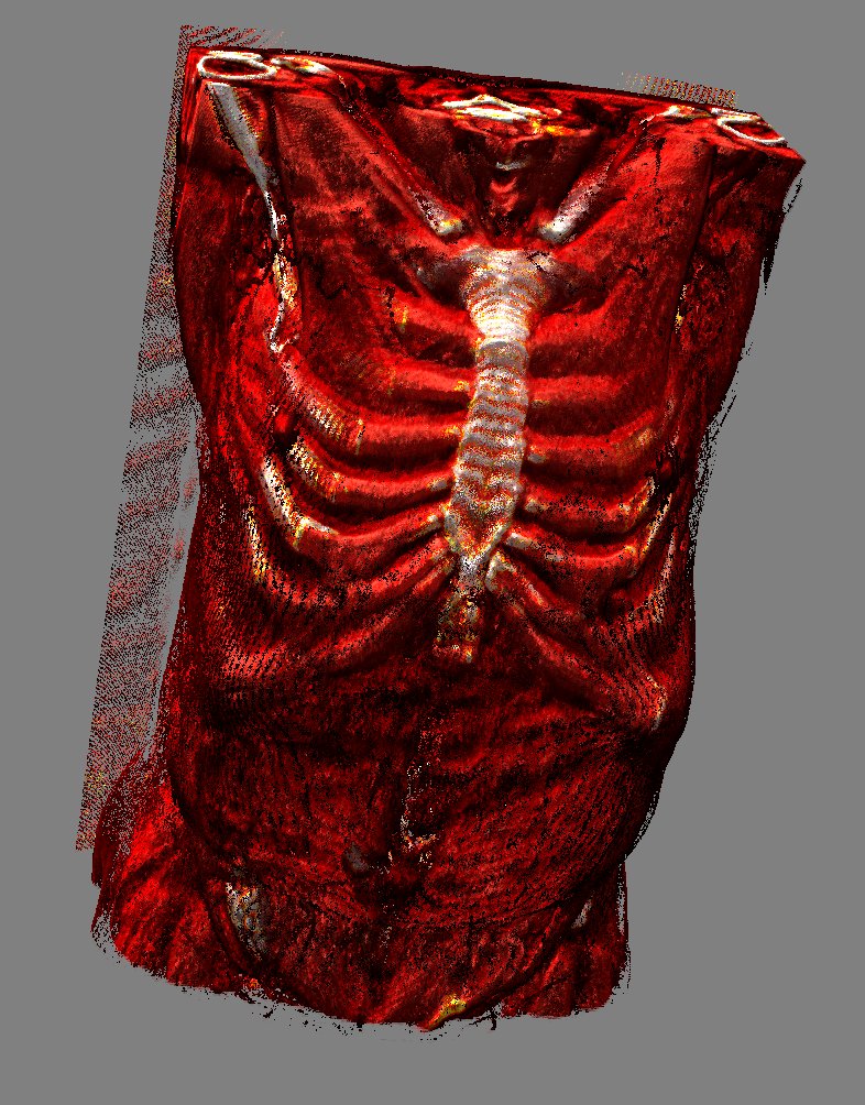 UCSFChimeraX's tweet image. In ChimeraX v1.9 daily builds 30/07/2024 or newer, raycasting can be used to render medical images and other volumes. Use 'volume projectionMode rays' or the new button on the medical image toolbar.