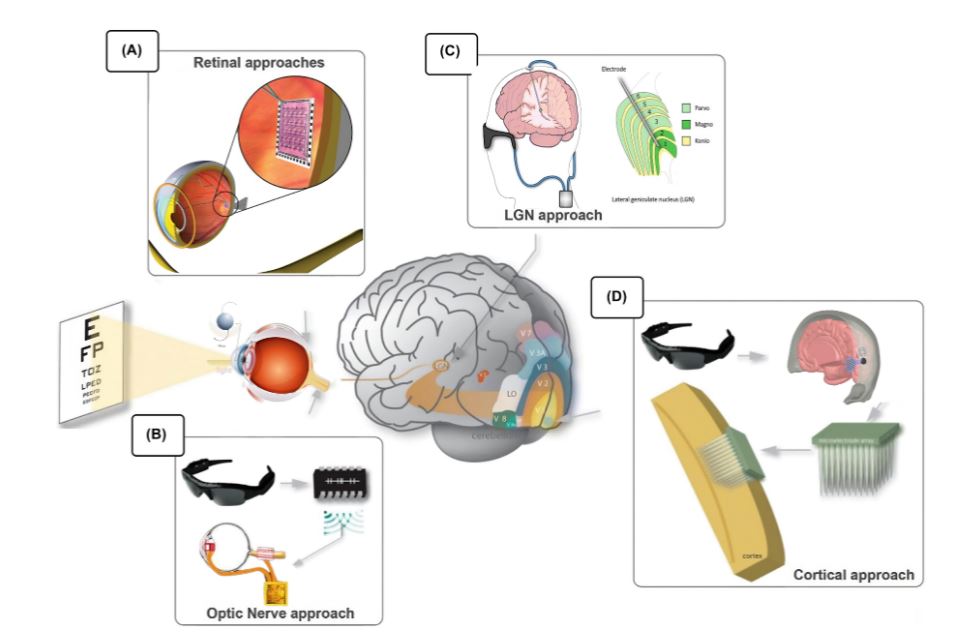 ArtifOrgans's tweet image. #Preprocessing visual scenes for #RetinalProsthesis systems: A comprehensive #review
👉tinyurl.com/yck2ena9
@NileUniversity🇪🇬| @Heidi_Holiel #BionicEye #DeepLearning