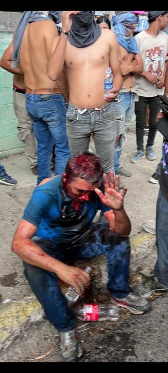 En Carora el fascismo se dio el lujo de golpear y humillar a un joven que estaba en la sede del PSUV. Esto lo hacen sin ser gobierno, imagínense si llegaran a Miraflores. Nuestro pueblo ya eligió la Paz y rechaza todo tipo de violencia fascista.
¡No pasarán! <a href="/NicolasMaduro/">Nicolás Maduro</a>