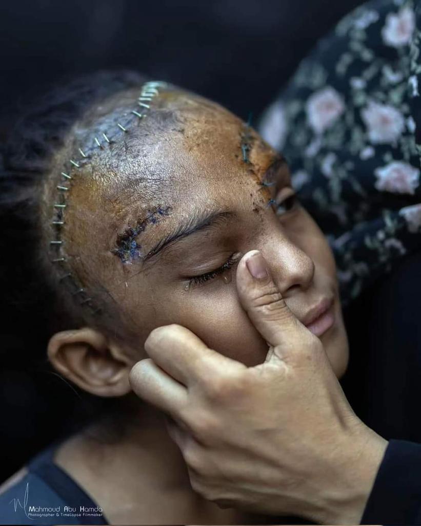 عزيزي العالم
لا يمكن أن تكون أكثر انحطاطا بعد هذا
نحن شهود على أقصى درجة من تعطيل الانسانية 
ليس هناك ما هو أبشع من ذلك لا في الماضيّ ولا في المستقبل.
عزيزي العالم
أتمنى لك نهاية قريبة.