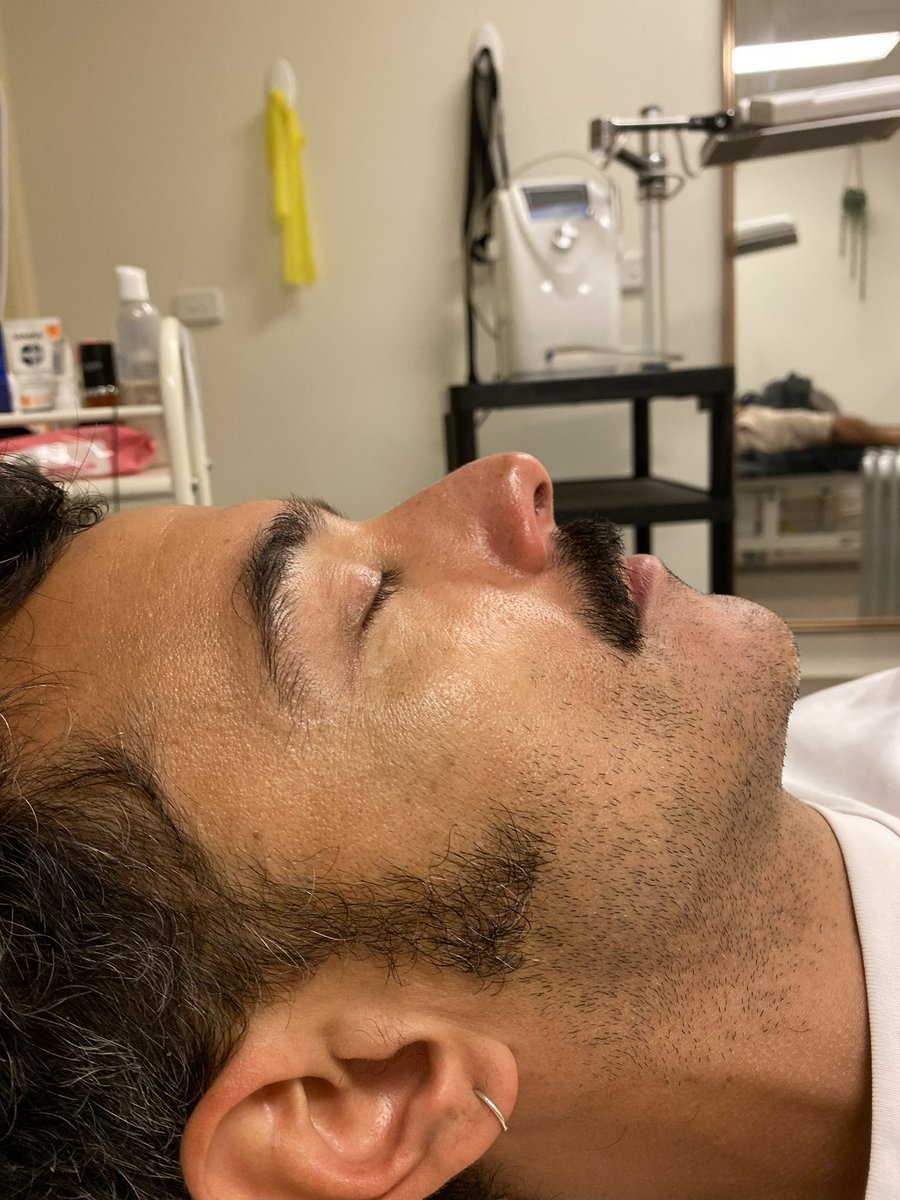 Never really had a facial before(not the kind you’re thinking😅) but I got the pleasure of having my first @waverleyledandfacials by David on the weekend😊