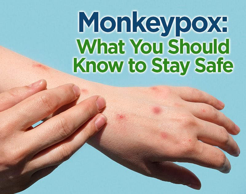 How concerned are you about 🐵 pox on a scale of 1-10 with 1 being no concern at all??