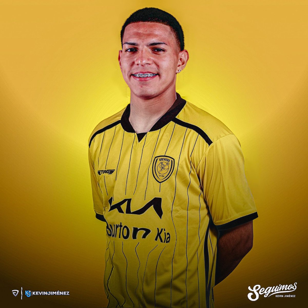 KevinJimenezCR's tweet photo. EXCL: Alejandro Bran está cerca de ser nuevo futbolista del Burton Albion de Inglaterra a préstamo un año con opción de compra.

• El Minnesota United le compró la ficha a Herediano como se informó hace unos días y lo cederá un año.

• ⁠El mediocampista tico jugará en Europa procedente de la MLS. 

• ⁠Viajará hoy a realizar pruebas médicas y luego firmar contrato.

A EUROPA. 🔥 🏴󠁧󠁢󠁥󠁮󠁧󠁿