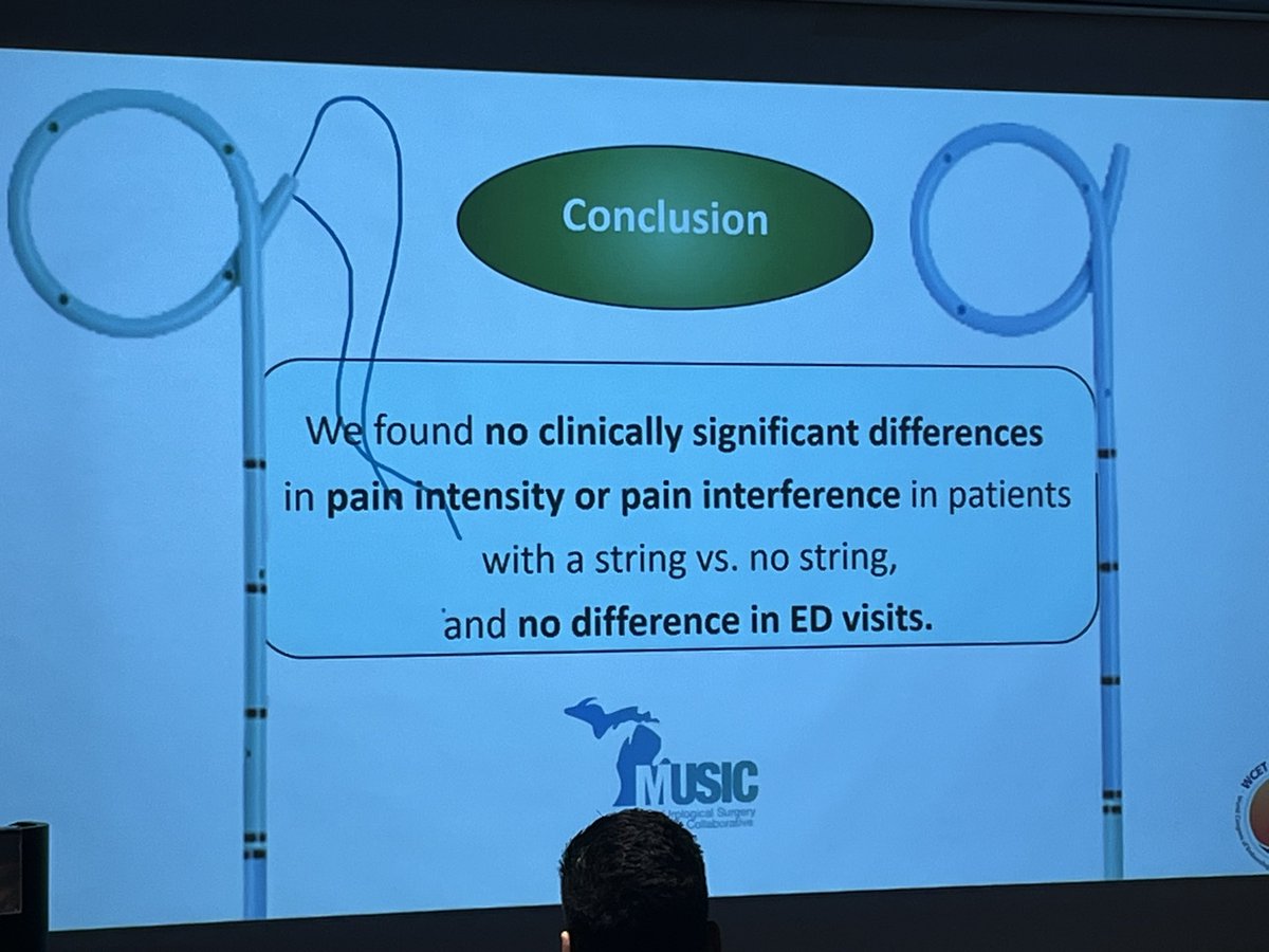 Daron Smith (@endoluminalendo) on Twitter photo To stent or not to stent… and what about strings attached?
Nice data from <a href="/peepeeDoctor/">Khurshid Ghani</a> and the MUSIC team <a href="/caseydauw/">Casey Dauw</a>
<a href="/MUSICUrology/">MUSIC Urology</a>
Maybe the short dwell time stent on string could have no Strings and no stent…
#WCET24
<a href="/Endo_Society/">Endourological Society</a>
<a href="/BEkidneystone/">Brian Eisner</a> To stent or not to stent… and what about strings attached?
Nice data from <a href="/peepeeDoctor/">Khurshid Ghani</a> and the MUSIC team <a href="/caseydauw/">Casey Dauw</a>
<a href="/MUSICUrology/">MUSIC Urology</a>
Maybe the short dwell time stent on string could have no Strings and no stent…
#WCET24
<a href="/Endo_Society/">Endourological Society</a>
<a href="/BEkidneystone/">Brian Eisner</a>