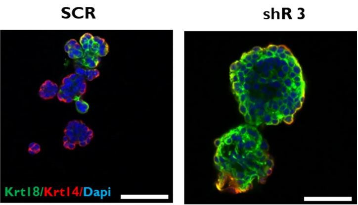 MammaryCell's tweet photo. The relationship between FBLN2 expression and epithelial markers π was investigated in pubertal mouse #mammary glands and the EpH4 π mouse mammary epithelial cell line using immunohistochemistry, immunocytochemistry, and immunoblotting.
π https://t.co/cs9nPzGufi https://t.co/HZeljZWixD
