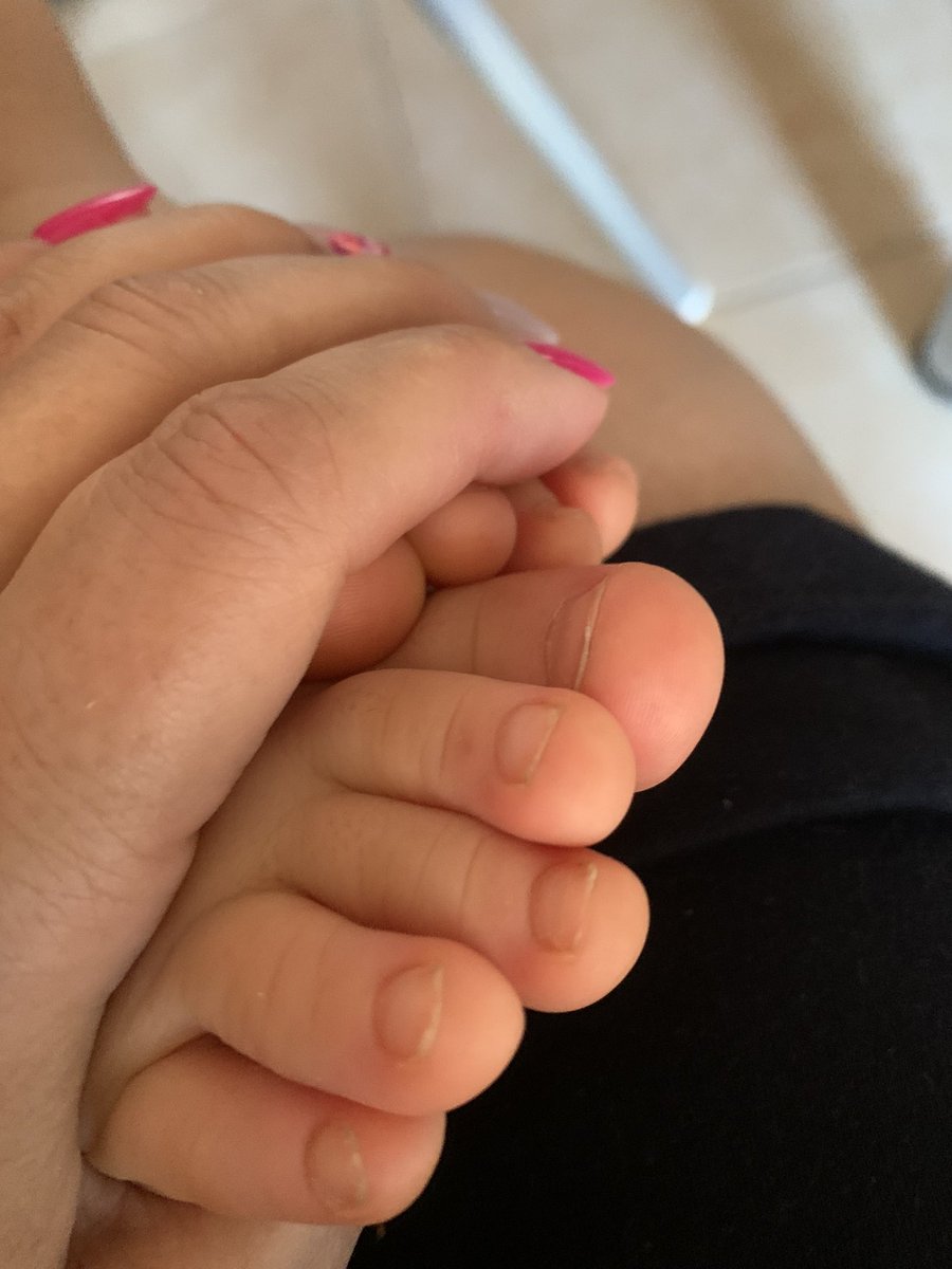 Tam diyete başlamıştım yine mis gibi poğaçalar geldi 😍💙