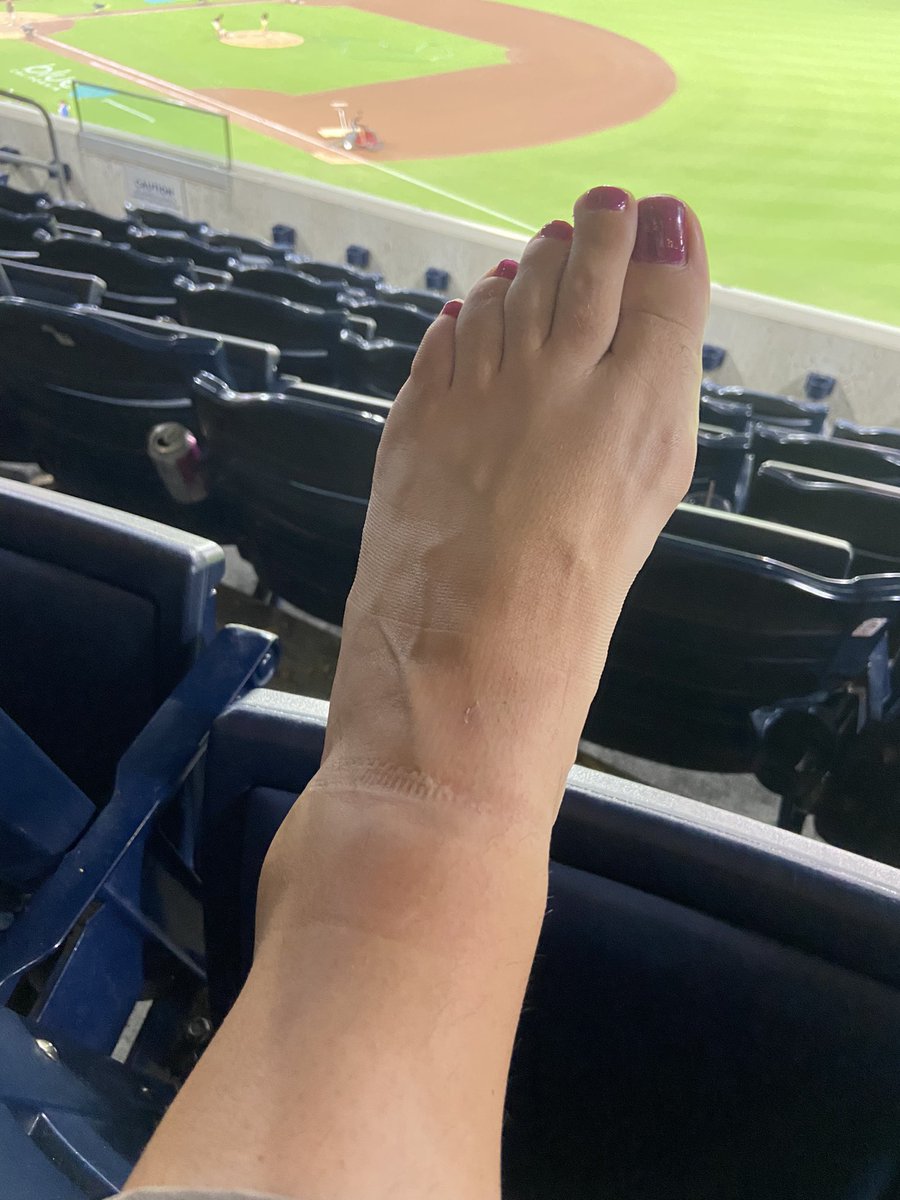 Angel Roy (@angeliquedroy) on Twitter photo 20 days until our wedding.
Protected my face but took the foul ball from <a href="/the_higster/">Kyle Higashioka</a> directly off my ankle 🫠
Glad for a <a href="/Padres/">San Diego Padres</a> win but holy hell omg. 20 days until our wedding.
Protected my face but took the foul ball from <a href="/the_higster/">Kyle Higashioka</a> directly off my ankle 🫠
Glad for a <a href="/Padres/">San Diego Padres</a> win but holy hell omg.