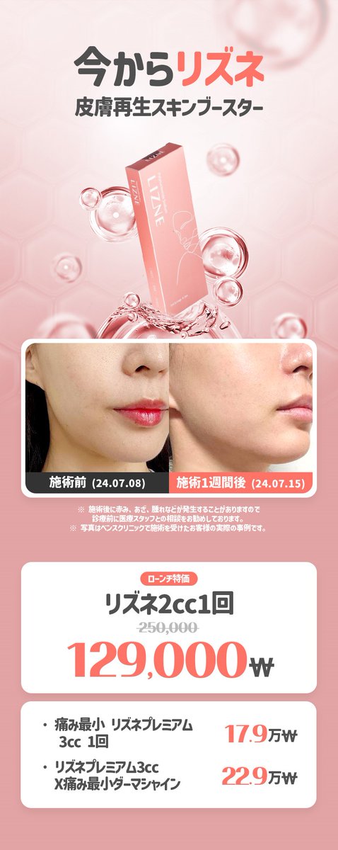 最強のリフティング！#チタニウムリフト も #ユアクリニック #ベンスクリニック で
#ホンデ #明洞 店で施術可能💎

#チタニウムリフト #サーマジ✨イベント✨
#二重顎 39万₩
顔全体プレミアム 89万₩
#サーマジFLX イベント 300s 119万₩(600s以上の場合)

リツイート&amp;フォローすると8月以降も適用✨