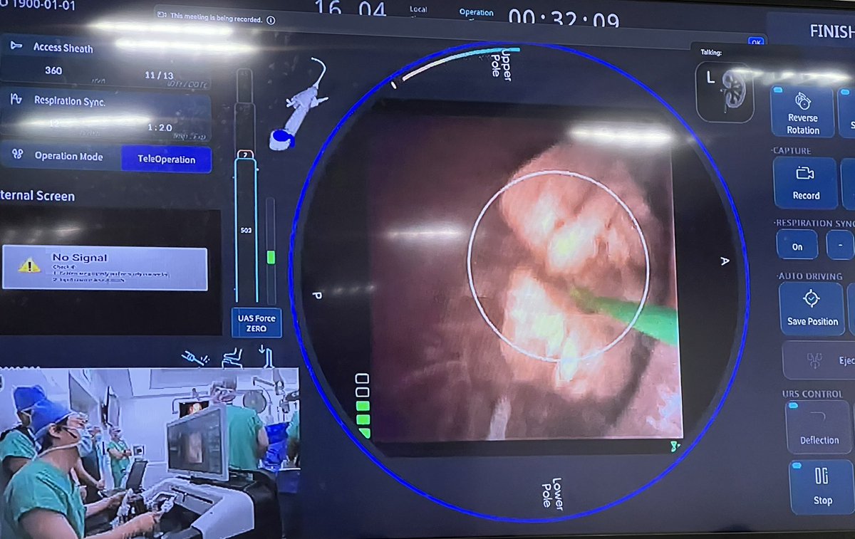 tzevattefik's tweet photo. Gr8 demonstration @kmoretry of live robotic RIRS w #Zamenix following the memorable day after the first clinical trial

Tips,Tricks &amp; Challenges
Best hospitality at @snuh_official 

@wissamabokhalid @rifat_burak @miurologa @jl_kwok @LeeHsiangYing1

#wcet24
#RoboticsInEndourology https://t.co/zxmEnjYAwk