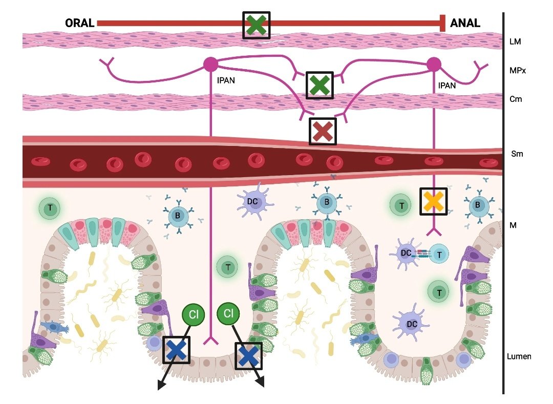 mpascualmato's tweet photo. Beta-CGRP reduction in IBD would induce four distinct actions:
1️⃣Vasoconstriction of submucosal blood vessels
2️⃣inhibition of secretion of Cl in enteric cells, which can cause damage
3️⃣Lymphocyte  proliferation, activation and cytokine release
4️⃣Inhibition of oral/anal propulsion https://t.co/UTQg7kA9vg