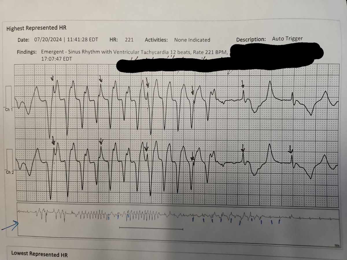 Devil is in the disclosure strip #Epeeps #EPfellows #Biotel