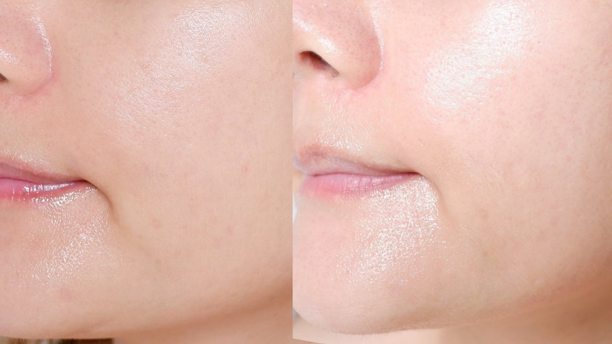 Skintific Symwhite 377 ตัวนี้หวานแบ่งกันใช้กับแฟน แฟนใช้ก็ชอบ เนื้อเซรั่ม+ครีม บางเบาสบาย ผิวชุ่มชื้น ใช้คู่กัน รู้สึกพวกรอยแดง รอยสิวใหม่ ๆ จางลงไวมาก ปรับสีผิวให้สม่ำเสมอ ผิวดูเรียบเนียนขึ้นด้วย
#ใช้ดีบอกต่อ #skintificth https://t.co/pSi5X0EOSv