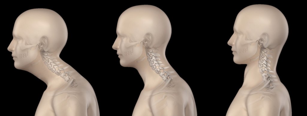 How to fix Nerd Neck 🪄

By popular demand, here's a thread of tips for addressing this increasingly common issue.