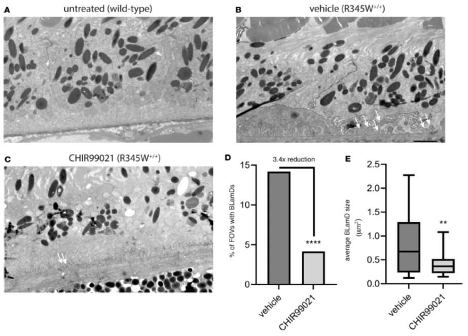 HullemanLab (@hullemanlab) on Twitter photo Very excited to share our recent work just published in <a href="/JCI_Insight/">JCI insight</a>. Low level #GSK3 inhibition via CHIR99021 remodels the #ECM and prevents BLamDs in an early-onset #AMD mouse model. Congrats to Sophie DiCesare on a great paper! <a href="/UMNews/">University of Minnesota</a>
insight.jci.org/articles/view/… Very excited to share our recent work just published in <a href="/JCI_Insight/">JCI insight</a>. Low level #GSK3 inhibition via CHIR99021 remodels the #ECM and prevents BLamDs in an early-onset #AMD mouse model. Congrats to Sophie DiCesare on a great paper! <a href="/UMNews/">University of Minnesota</a>
insight.jci.org/articles/view/…