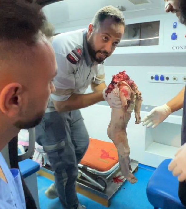 TheSaviour's tweet photo. 🚨🇮🇱 ISRAEL JUST BEHEADED ANOTHER BABY IN GAZA!!

THIS IS F*CKING HORRIFIC!! https://t.co/uCTndmUcb3