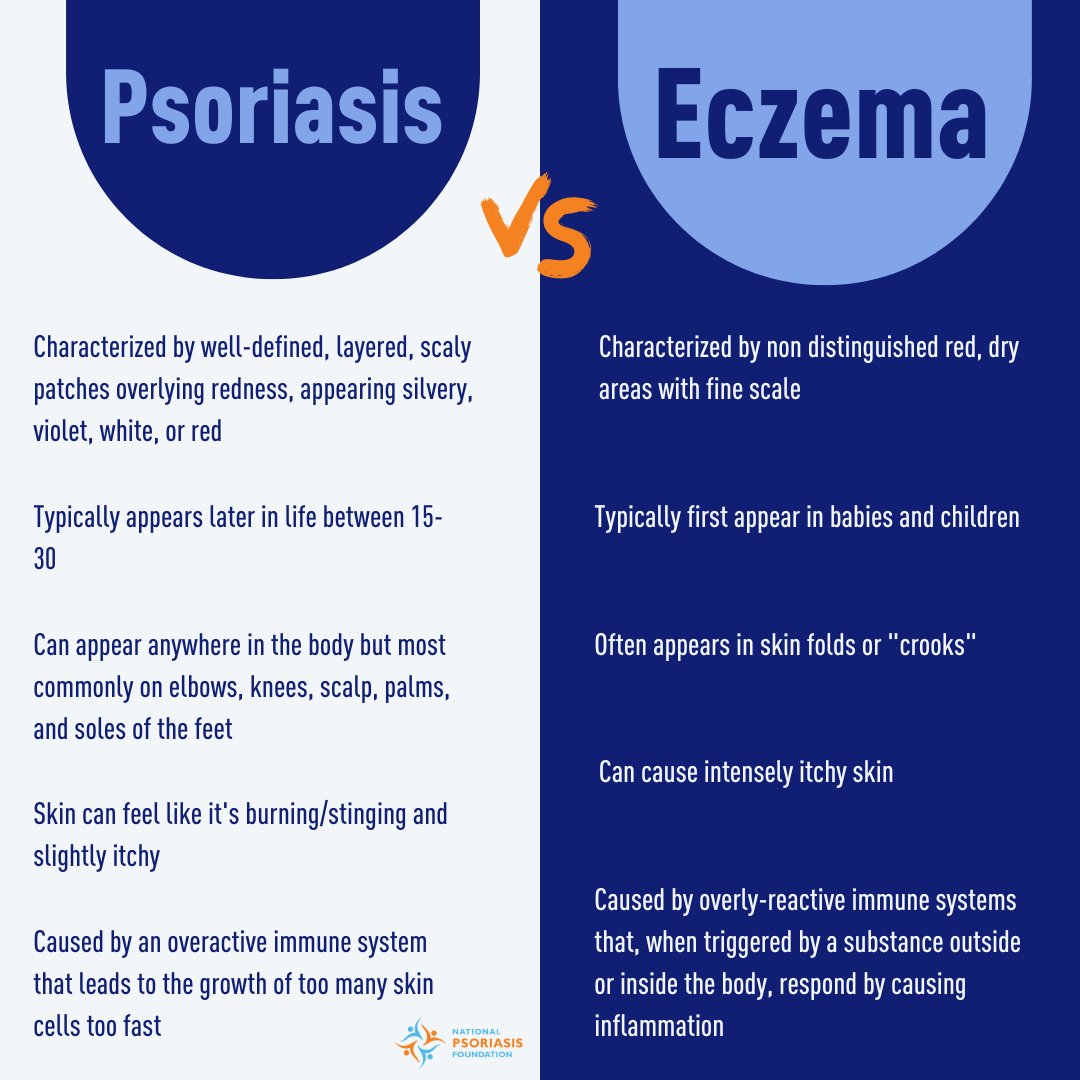 NPF's tweet photo. #ThisIsPsoriasis .... not eczema
While psoriasis and eczema might look similar, deep down, they are quite different. Get all the facts about the similarities and differences on our website 🔗https://t.co/LdGxe1uQ4T https://t.co/kaxbrFhm9O