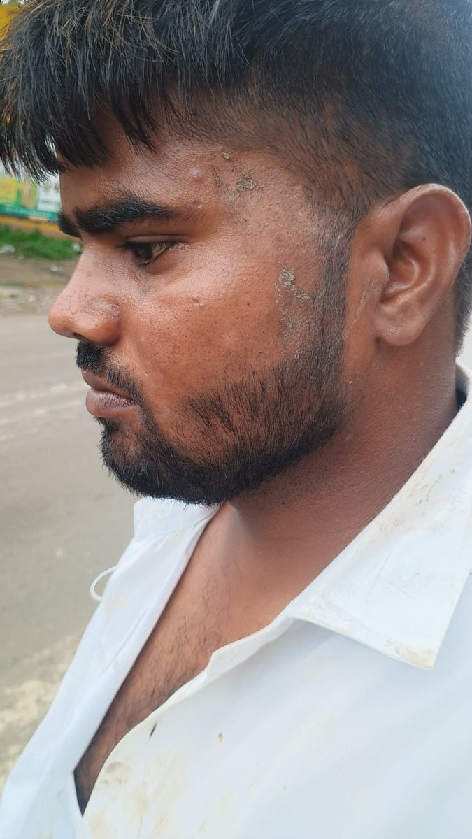 रामकोट थाना क्षेत्र भीम आर्मी के कार्यकर्ता को ब्राह्मण ने मारा पुलिस विपक्षियों को बचाने के लिए पीड़ित पर ही मुकदमा दर्ज करने की धमकी दी जा रही। भीम आर्मी के सभी साथी तैयार रहें कल विरोध प्रदर्शन 11:00 बजे अंबेडकर पार्क #सीतापुर । <a href="/sitapurpolice/">Sitapur Police</a> <a href="/Uppolice/">UP POLICE</a> <a href="/BhimArmyChief/">Chandra Shekhar Aazad</a>