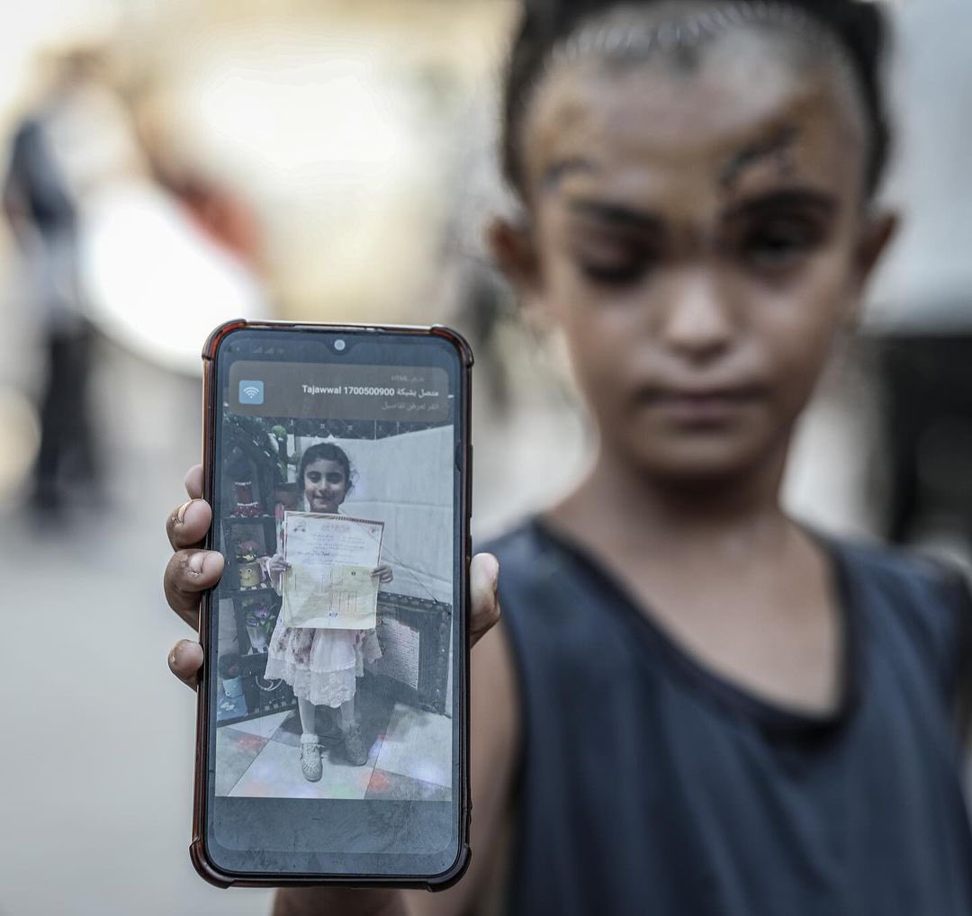 Timesofgaza's tweet photo. Seven-year-old Palestinian child from Gaza suffers serious wounds sustained in a previous lsraeli airstrike targeting a school in Deir al-Balah, central Gaza Strip. https://t.co/gebc6zDxOg