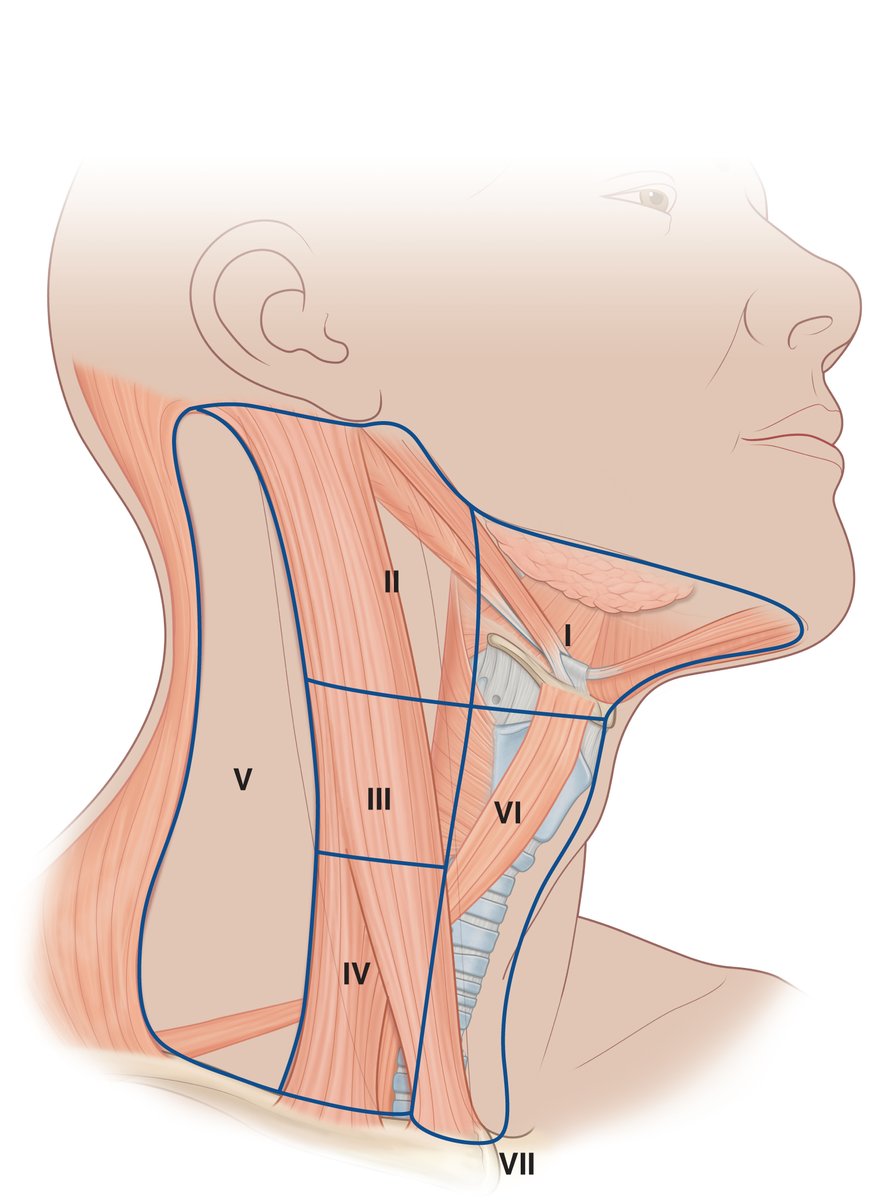 PasionAnatomia's tweet photo. Regiones del #cuello (niveles) desde el punto de vista clínico para la evaluación de los #NódulosLinfáticos
📚Gray. Anatomía para estudiantes © 2024 https://t.co/G9CWe2gQdN