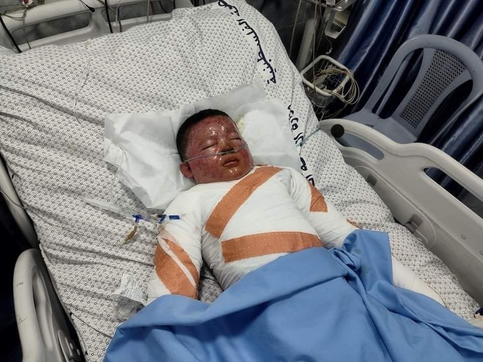 AnasAlSharif0's tweet photo. ارتفع عدد الشهداء في مجزرة مدرسة التابعين بحي الدرج في مدينة غزة، التي نفذها جيش الاحتلال الإسرائيلي، حيث استشهد الطفل عمر ياسر الجعبري (13 عاماً) في مستشفى كمال عدوان متأثراً بجراحه التي أصيب بها خلال المجزرة. https://t.co/REat9qZw6a