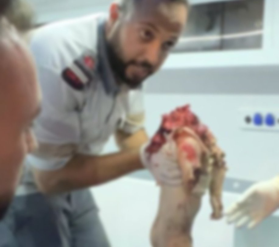 sarafromgaza's tweet image. This is the savage world we live in 💔