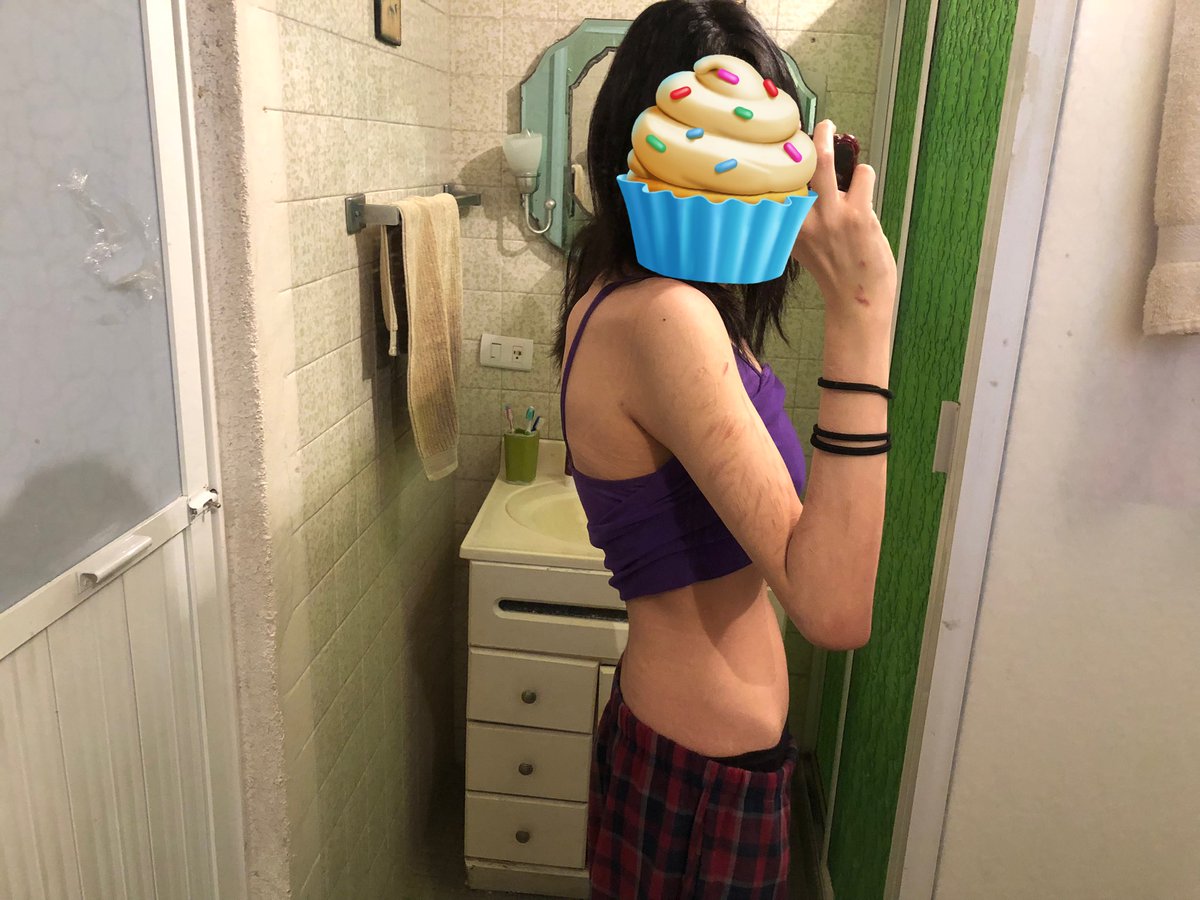 Ameru_Lucifer's tweet photo. Oigan, felicítenme!!
Me siento tan triunfal JAJAJA

La primera foto es de junio, pesaba 64 fokin kilos, y ahora por fin salí de los 50 kilos, vamos por esos 40kg!!

(Mido 1,64) https://t.co/teWbKhDa05
