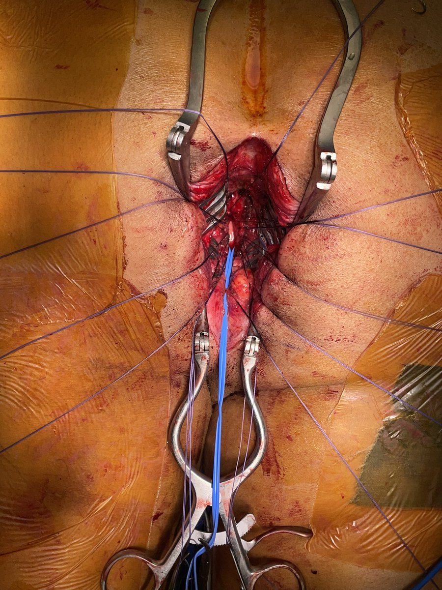 Humberto Villarreal, MD MSCI tweet media