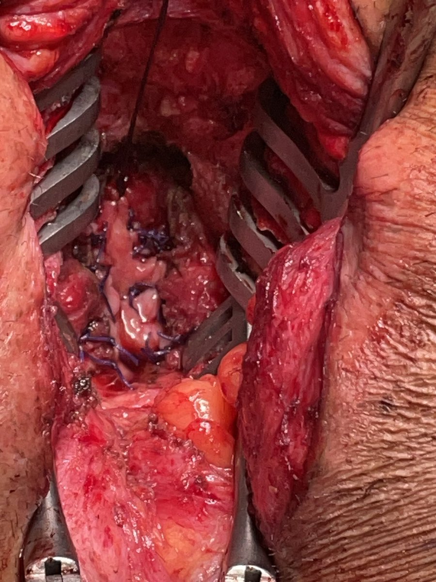 Humberto Villarreal, MD MSCI tweet media